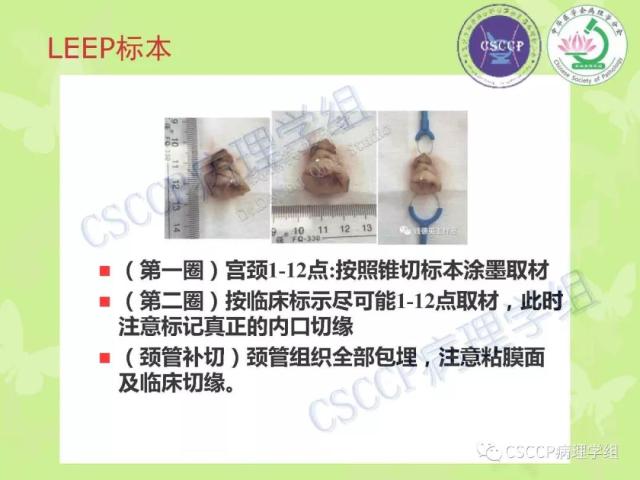 宫颈与子宫病变病理标本取材