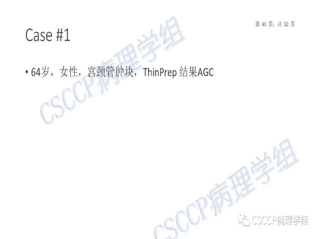 Atypical glandular cells: Recent Advances 非典型腺细胞新进展
