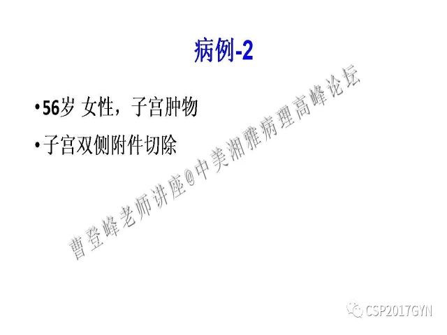 妇科肿瘤病理新进展——特殊类型的腺癌