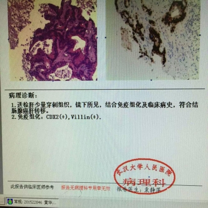 病理科新技术（二）：穿刺组织学明确诊断