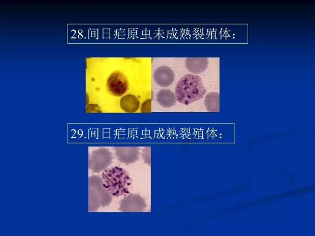 收藏！寄生虫图谱大全