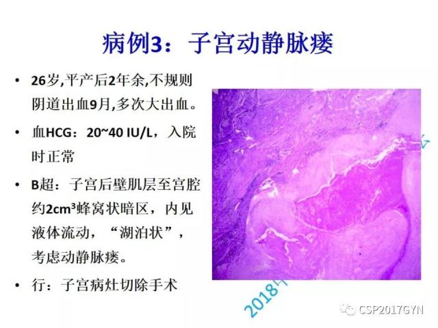 病理临床结合 开拓诊断视野