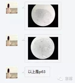 前列腺腺癌？（芳分享病例，华夏泌尿群讨论，孔祥田老师讲解）