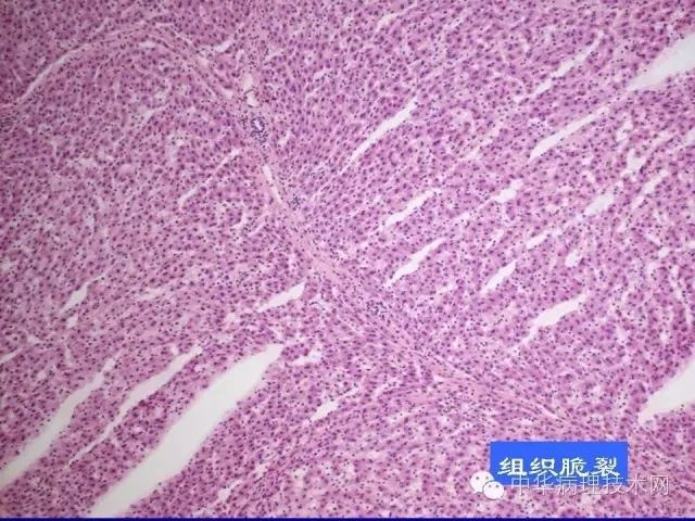影响冰冻切片质量的原因（比赛注意事项）