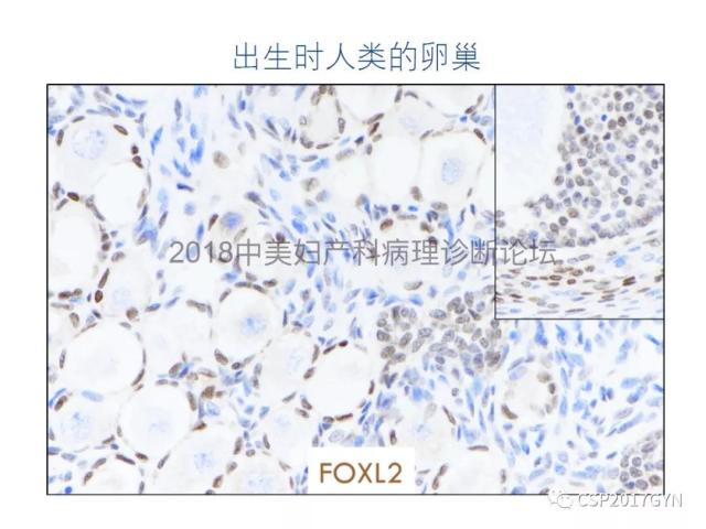 女性生殖道发育