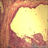 2012-06-06