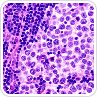 Webpathology.com-镜像翻译（自学使用，版权归原网站所有）