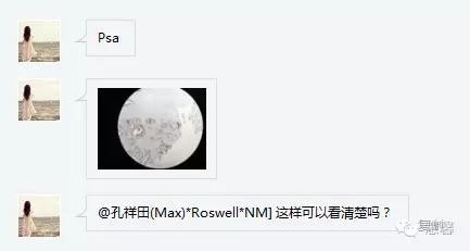 前列腺腺癌？（芳分享病例，华夏泌尿群讨论，孔祥田老师讲解）