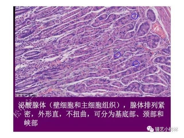 上消化道早癌病理的学习心得体会（附胃牵手癌的病例特点文献学习）