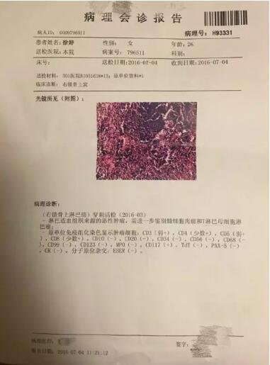 90后女演员患淋巴瘤去世，淋巴瘤这些知识你不可不知