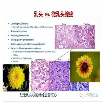 肺癌新分期和分类--临床和研究启示