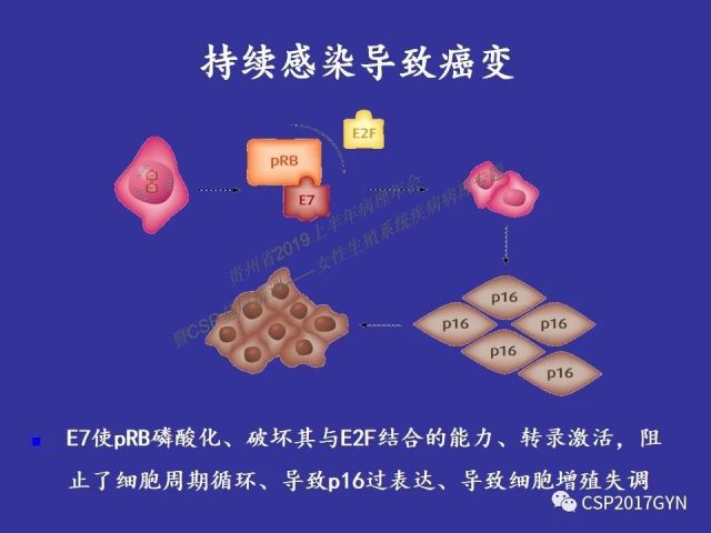 中华病理学会基层培训遵义站讲座（二）——宫颈细胞学诊断中陷阱与筛查进展