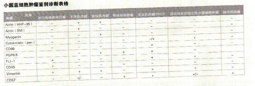小圆蓝细胞肿瘤鉴别诊断