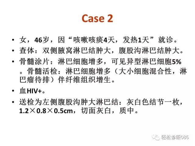 HIV/AIDS相关性LPDHIV感染相关淋巴瘤病例分析