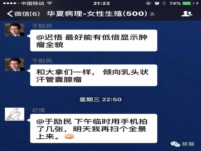 乳头状汗管囊腺瘤诊断及取材相关问题（迟悟分享，孔祥田及于励民老师讲解）