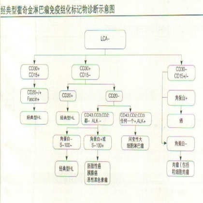 经典型霍奇金淋巴瘤免疫组化标记物诊断示意图
