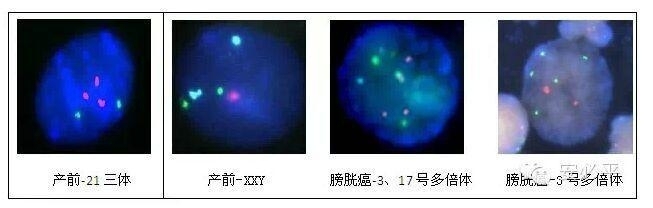手把手教你建立FISH阈值