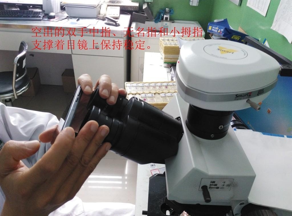 如何用手机对目镜拍出漂亮病理图片。
