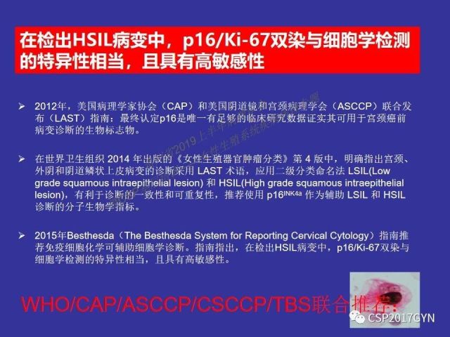 中华病理学会基层培训遵义站讲座（二）——宫颈细胞学诊断中陷阱与筛查进展