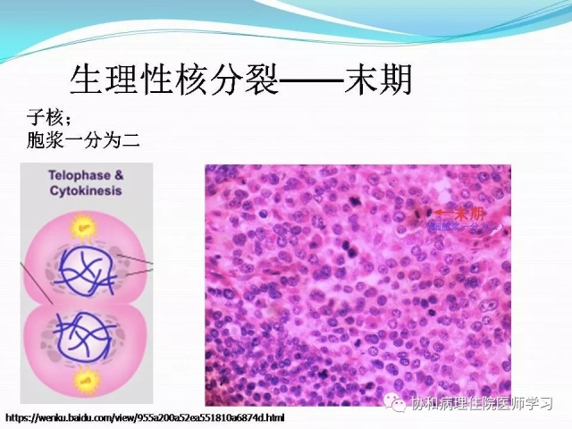 病理学基础知识 : 核分裂像的识别