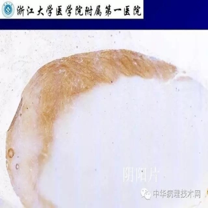 免疫组化液态阳性对照