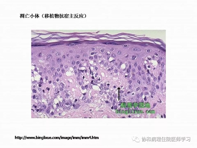 病理学基础知识 : 核分裂像的识别