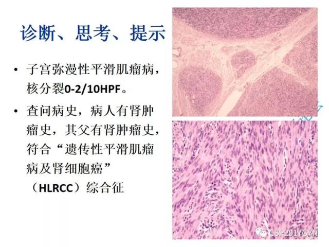 病理临床结合 开拓诊断视野