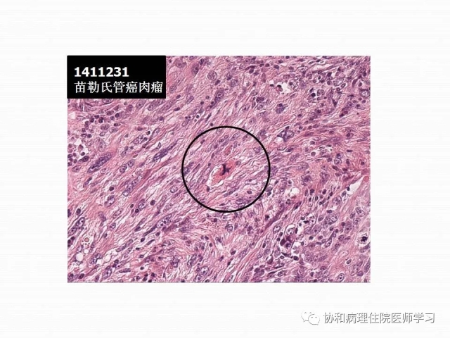 病理学基础知识 : 核分裂像的识别