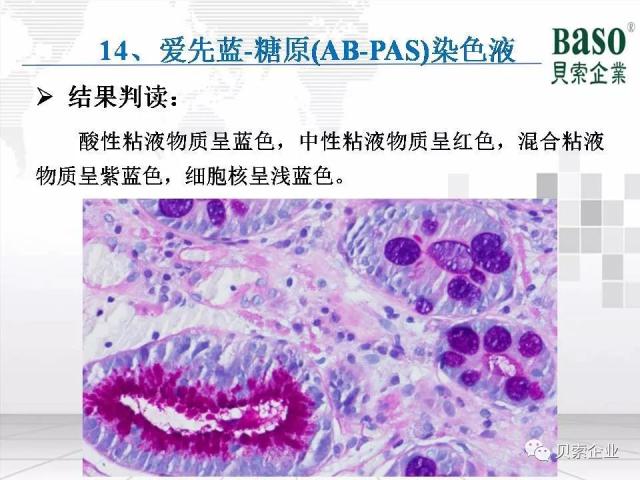 收藏:最全病理染色原理、染色流程、注意事项分享 收藏:最全病理染色原理、染色流程、注意事项分享