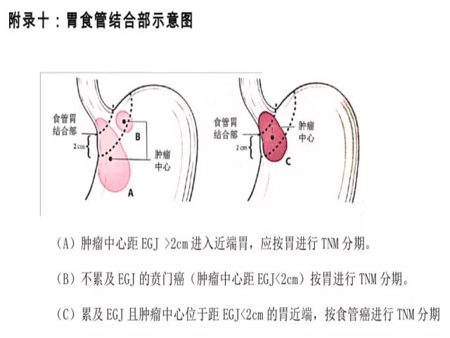 胃癌诊疗规范（2018年版）