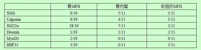 骨恶性纤维组织细胞瘤（骨MFH）