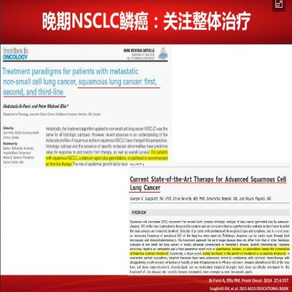 如何优化肺鳞癌的治疗