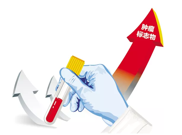 一文读懂：10大常用肿瘤标志物的临床应用
