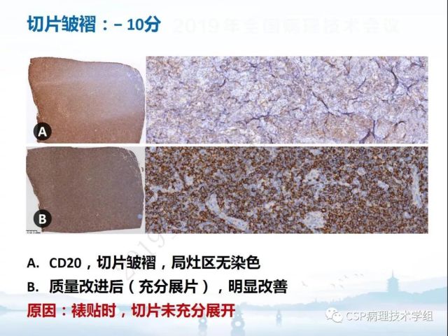 免疫组化检测的临床应用与质量评估