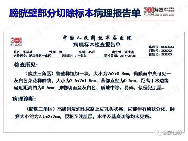 泌尿系统常见肿瘤标本病理报告规范