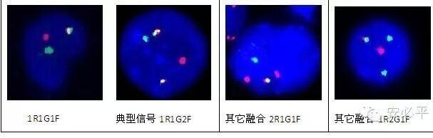 手把手教你建立FISH阈值