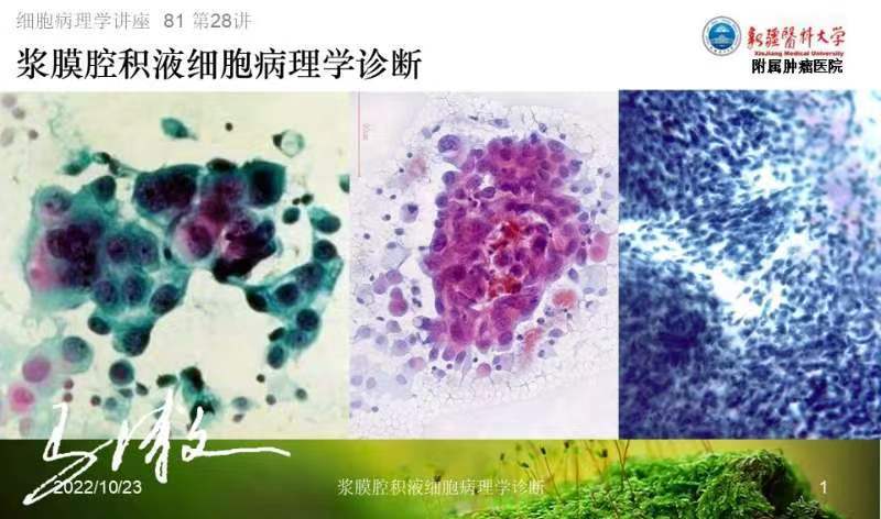 直播预告 | 今晚8点，马博文老师将为大家带来：《浆膜腔 积液细胞病理学诊断》，敬请期待！