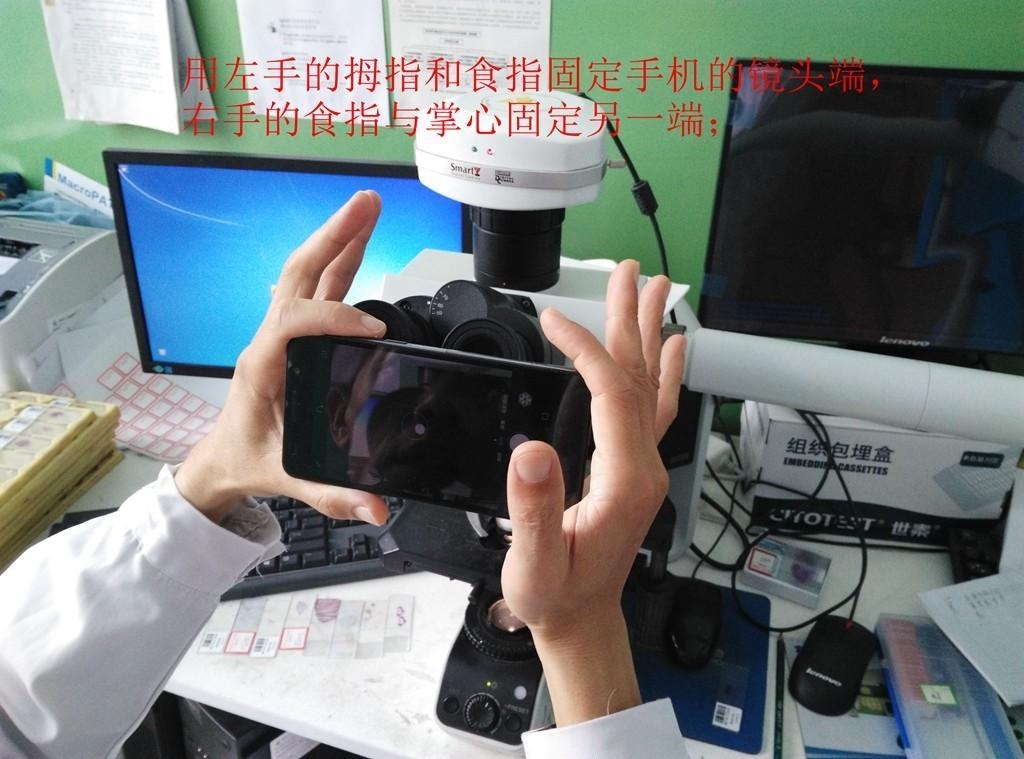 如何用手机对目镜拍出漂亮病理图片。