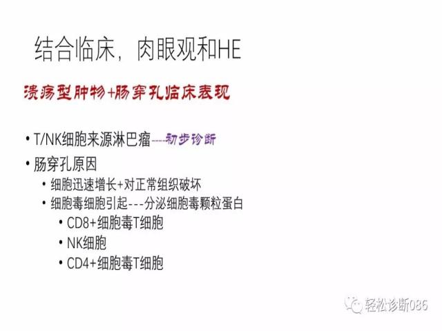 肠道T细胞淋巴瘤