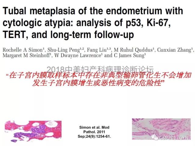 子宫内膜假肿瘤性病变及类似癌样病变