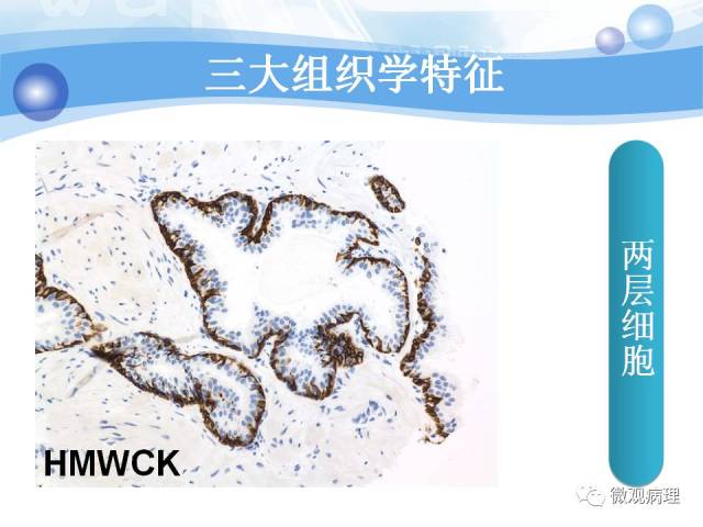 正常前列腺组织学