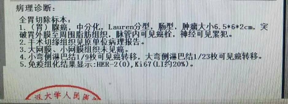 淋巴结数目和病理科质量管理水平