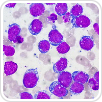 Webpathology.com-镜像翻译（自学使用，版权归原网站所有）