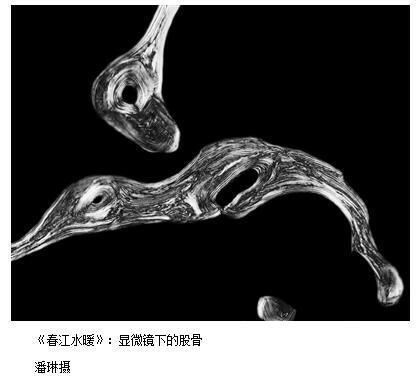 显微镜下的病理之美