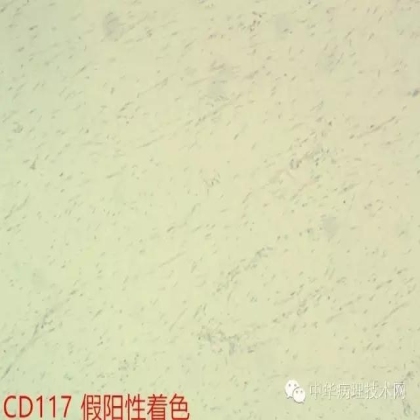 免疫组化结果的分析和常见问题的处理