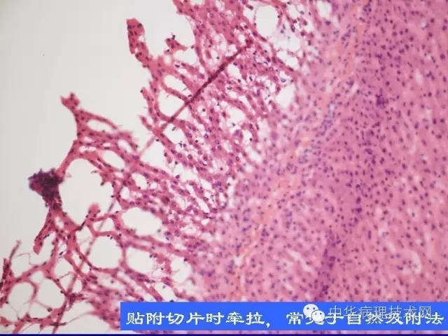 影响冰冻切片质量的原因（比赛注意事项）
