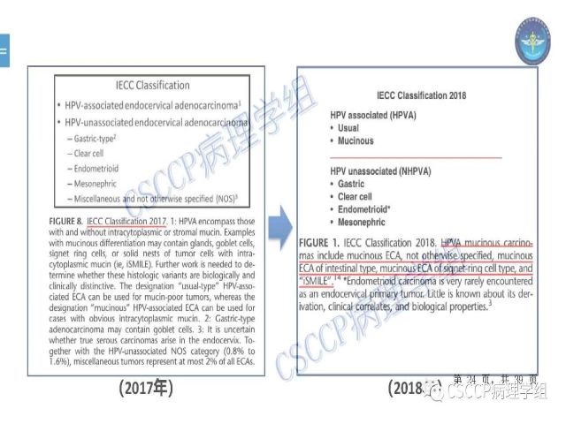 黄文亭 张询：宫颈腺癌分类介绍