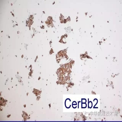 免疫组化液态阳性对照