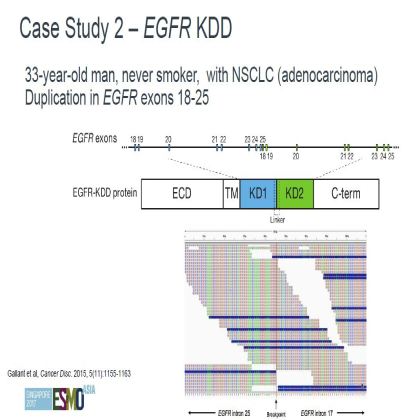 Genomic profiling of 114,200 advanced cancers identifies recurrent kinase domain duplications (KDD)