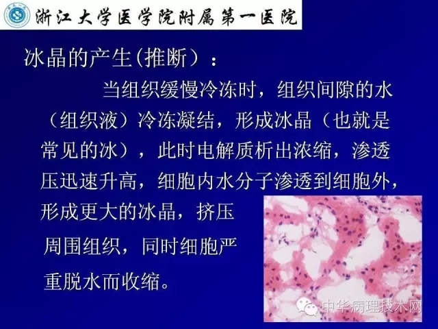 冰冻切片报告注意事项